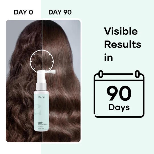 Mars Hair Loss Treatment Combo: Clinically Proven Serum, Biotin & Derma Roller - Image 5